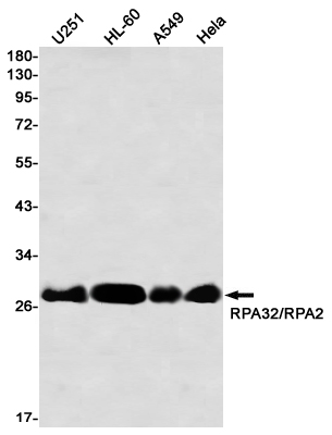 1 - RPA32 Rabbit mAb AP76696