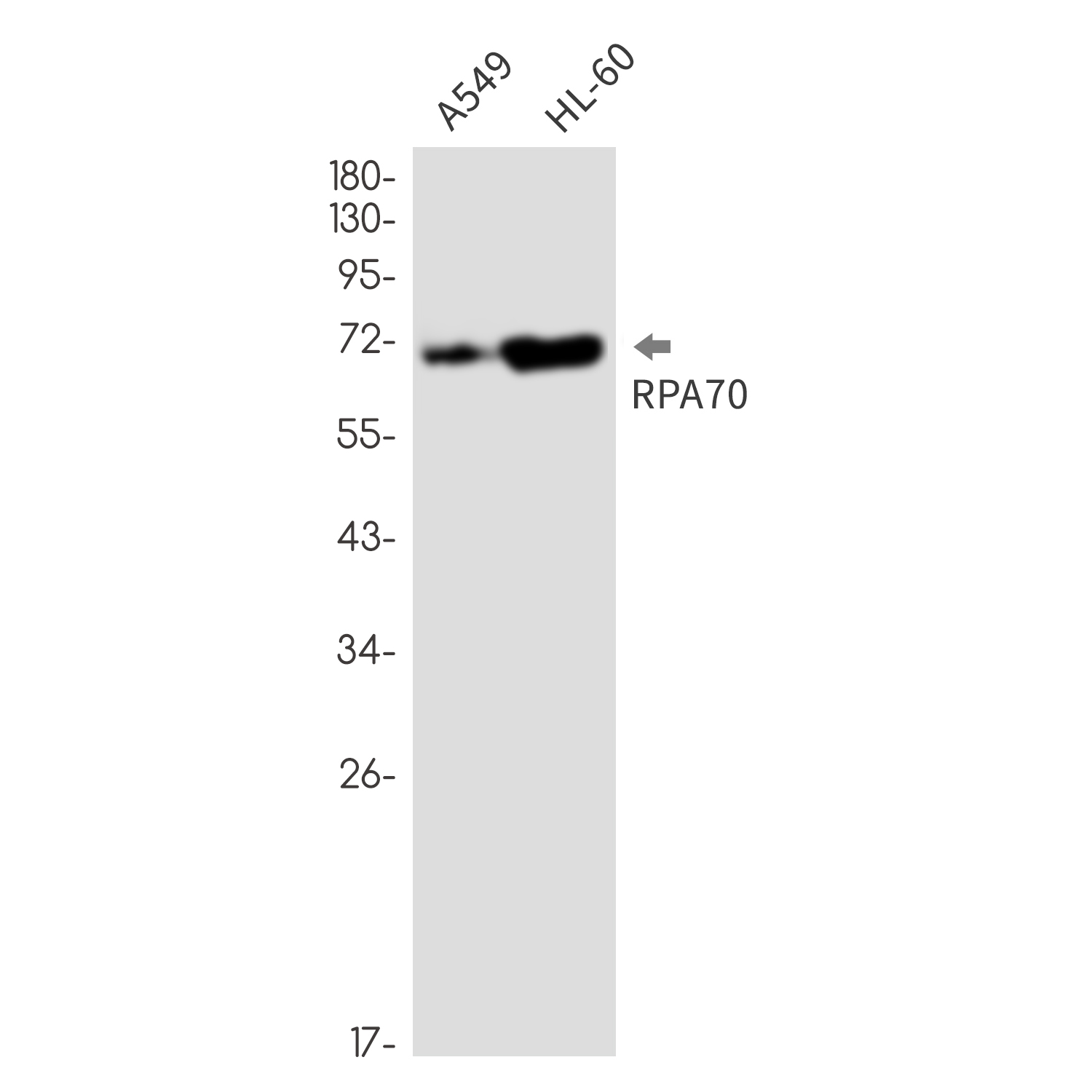 1 - RPA70 Rabbit mAb AP76697