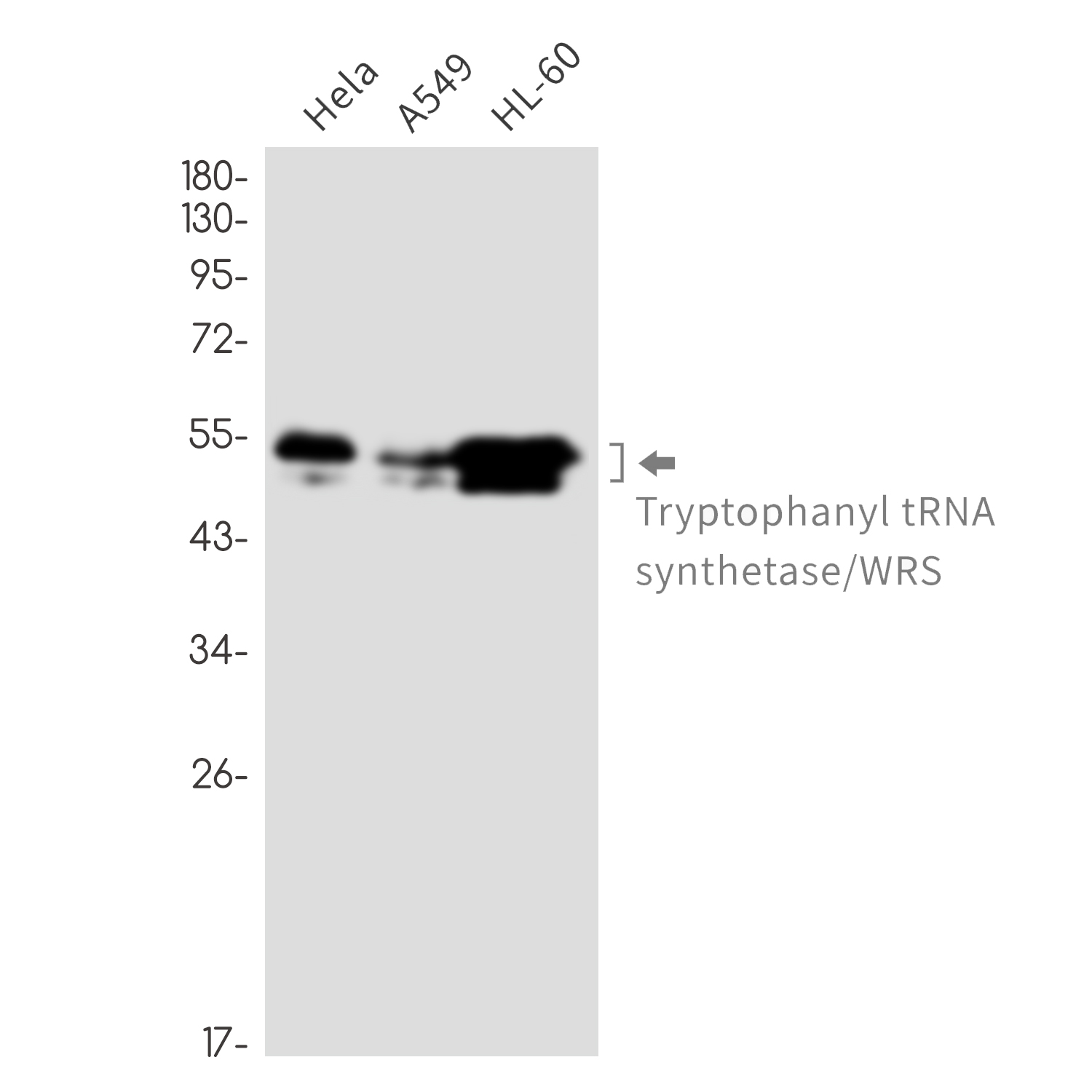 2 - Tryptophan tRNA Ligase Rabbit mAb AP76749