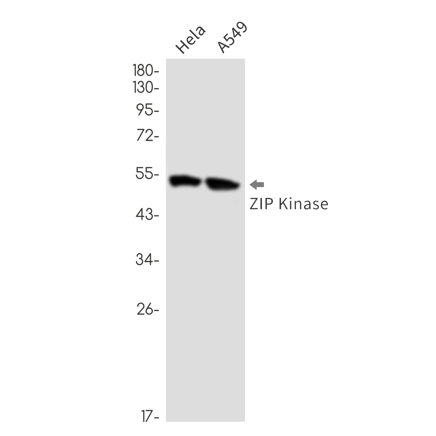 1 - DAP kinase 3 Rabbit mAb AP76771
