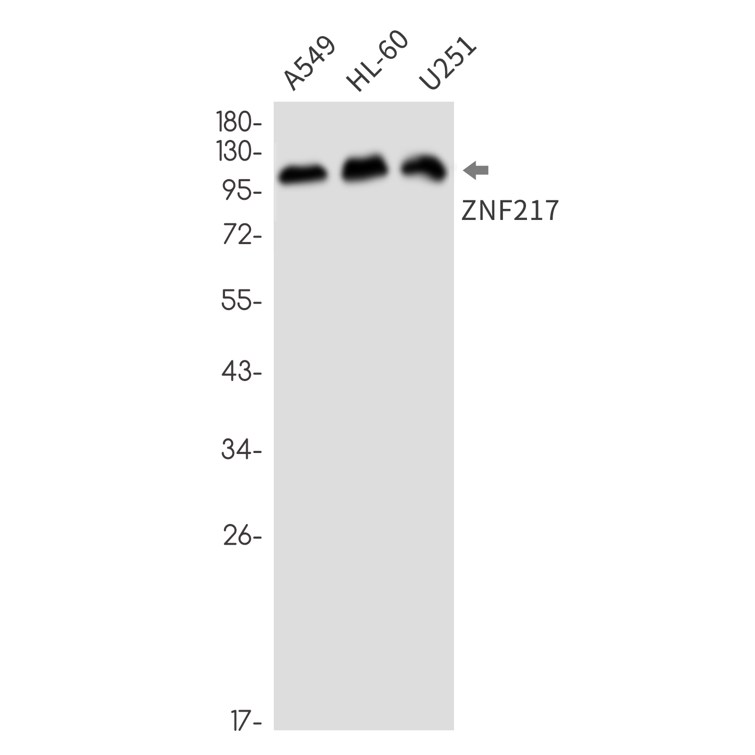 1 - ZNF217 Rabbit mAb AP76772