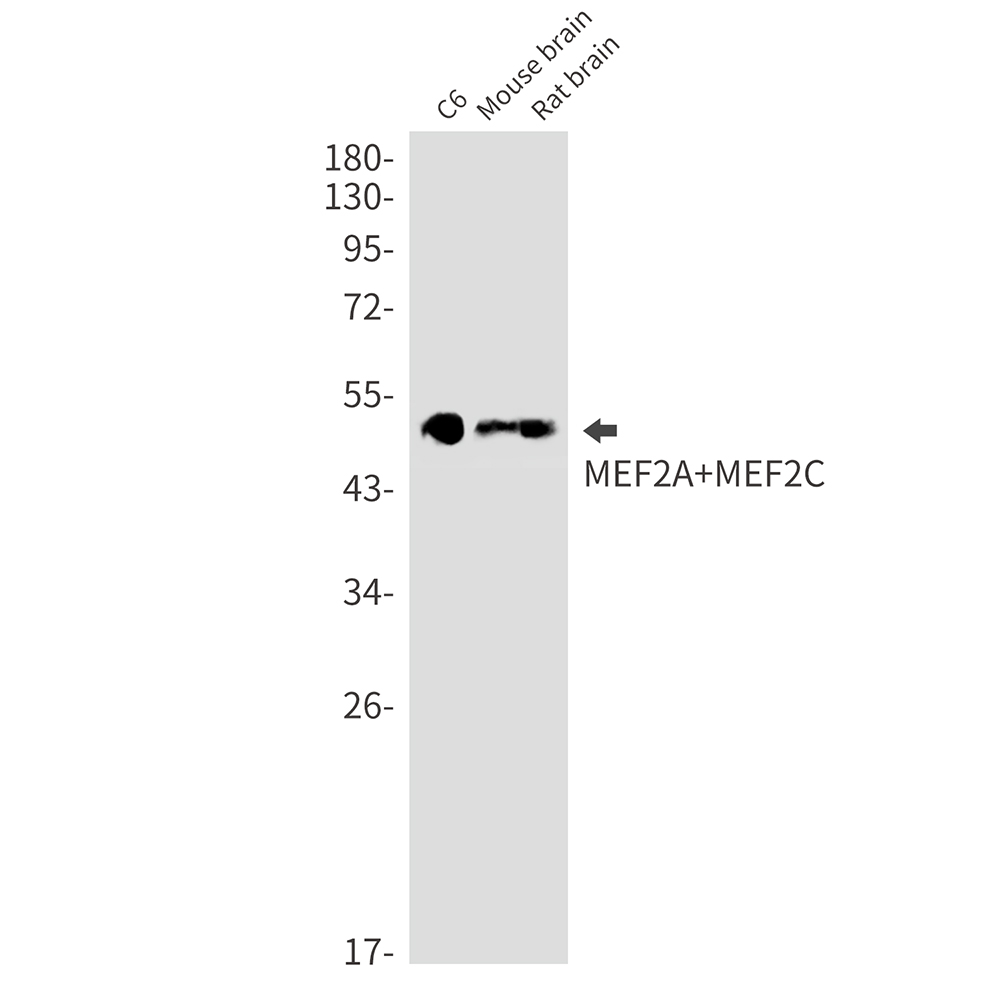 1 - MEF2A/MEF2C Rabbit mAb AP76778