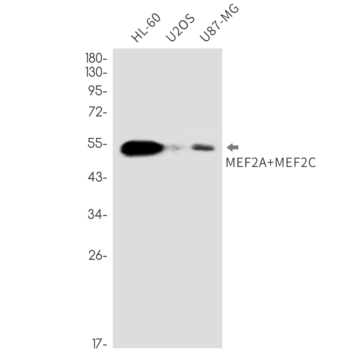 1 - MEF2A/MEF2C Rabbit mAb AP76778