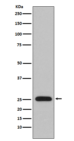 1 - Lambda Light chain Rabbit mAb AP78698