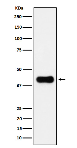 1 - ACAA2 Rabbit mAb AP78742