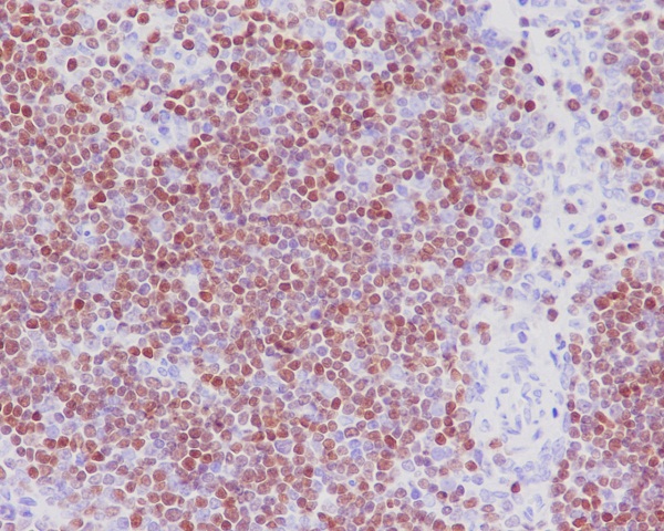 2 - SATB1 Rabbit mAb AP77408