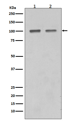 1 - SATB1 Rabbit mAb AP77408