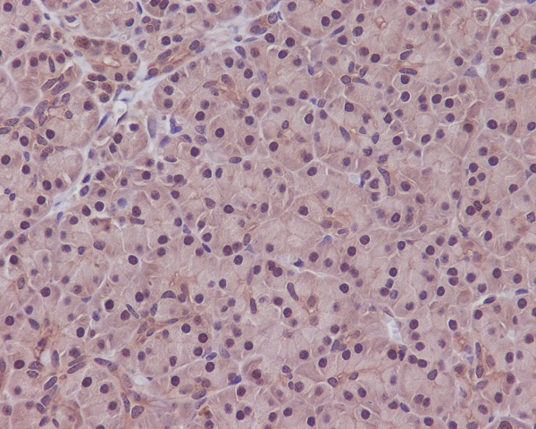 2 - PP1C alpha/beta Rabbit mAb AP78595