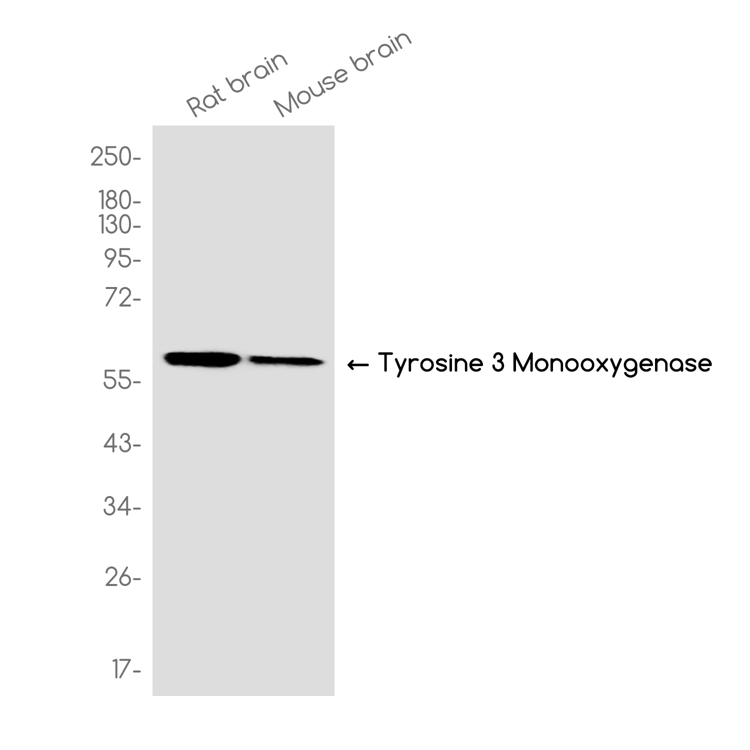 1 - Tyrosine Hydroxylase Rabbit mAb AP78965
