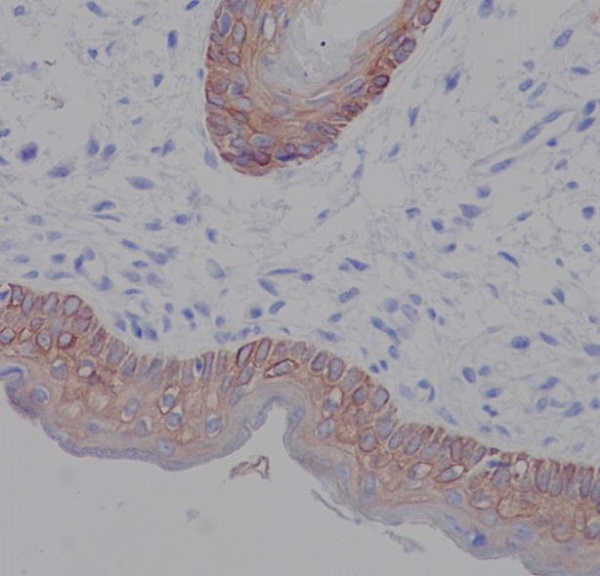 2 - Cytokeratin 5 Rabbit mAb AP77495