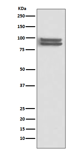 1 - FOXP1 Rabbit mAb AP77248