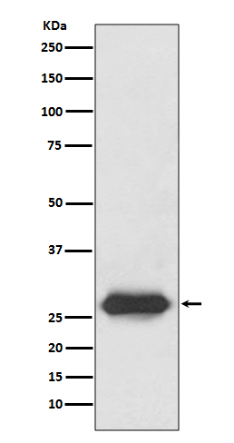 1 - LIN28 Rabbit mAb AP77633