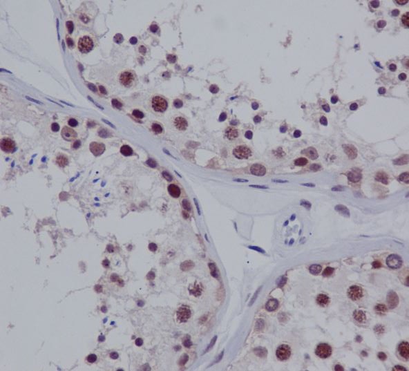 2 - PIAS1/2 Rabbit mAb AP77206