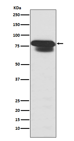 1 - PIAS1/2 Rabbit mAb AP77206
