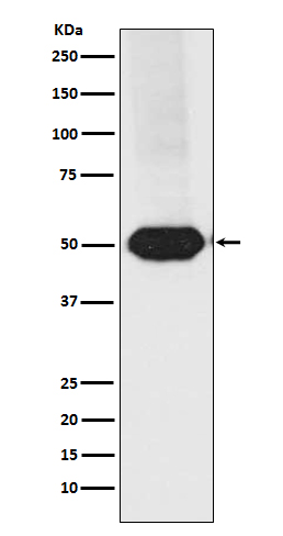 1 - MEF2A/MEF2C Rabbit mAb AP77692