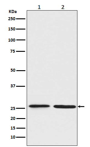 1 - BNIP1 Rabbit mAb AP77698
