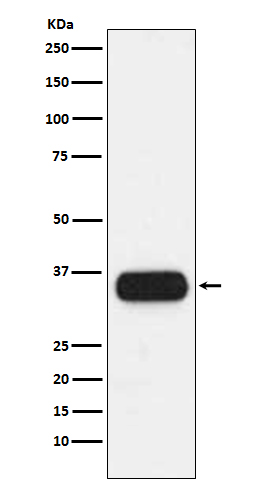 1 - HLA DQA1 Rabbit mAb AP77185