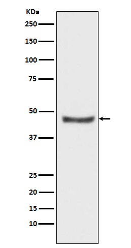 1 - PHD2 Rabbit mAb AP77184