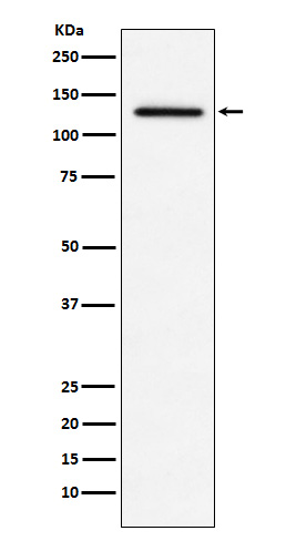 1 - MDA5 Rabbit mAb AP77169