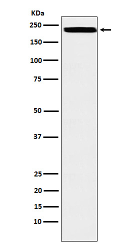 1 - ZEB1 Rabbit mAb AP77162