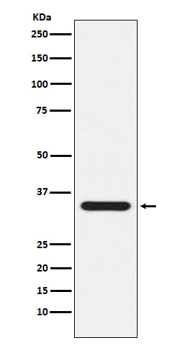 1 - Presenilin 1 Rabbit mAb AP77146