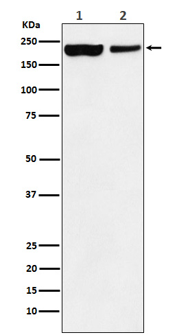 1 - KDM5A Rabbit mAb AP77877