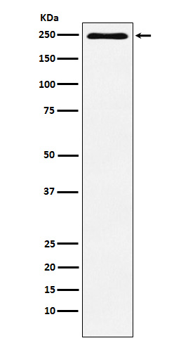 1 - Plexin A1 Rabbit mAb AP77887