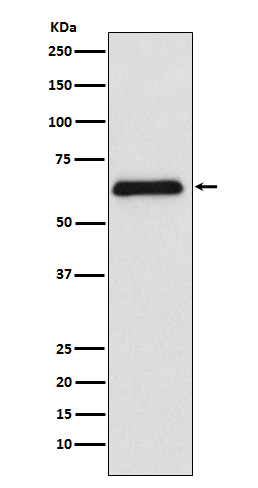 1 - PARP2 Rabbit mAb AP77112