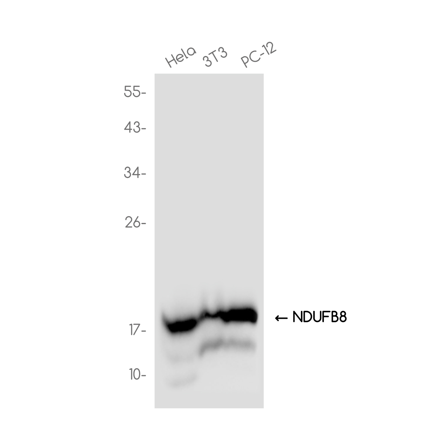 1 - NDUFB8 Rabbit mAb AP79016
