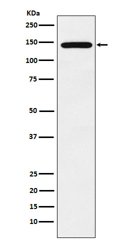 1 - Protein Jumonji Rabbit mAb AP78071