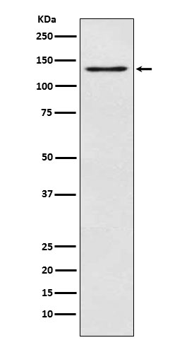 1 - OGA Rabbit mAb AP78081