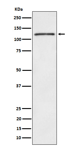 1 - FYB Rabbit mAb AP78120