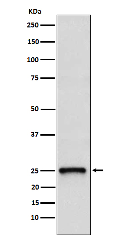 1 - RHOQ Rabbit mAb AP78137