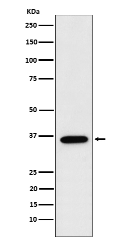 1 - FBP1 Rabbit mAb AP77067