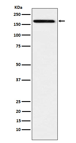 1 - IL-17 Receptor A Rabbit mAb AP78332