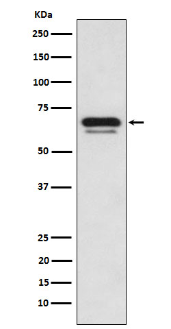 1 - GATAD2A Rabbit mAb AP77007
