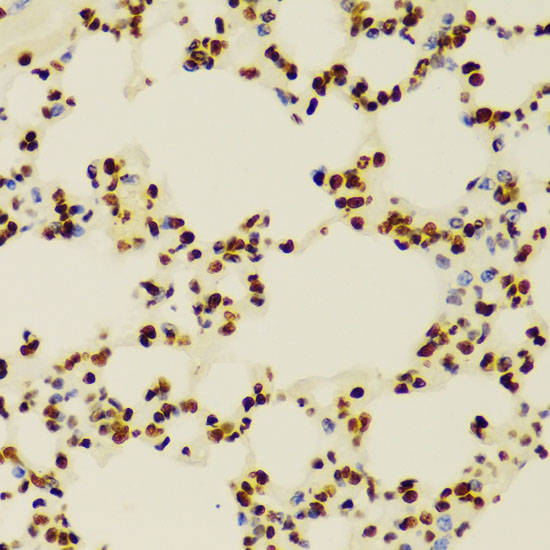 5 - DiMethyl-Histone H3 (Lys4) Rabbit mAb AP77005
