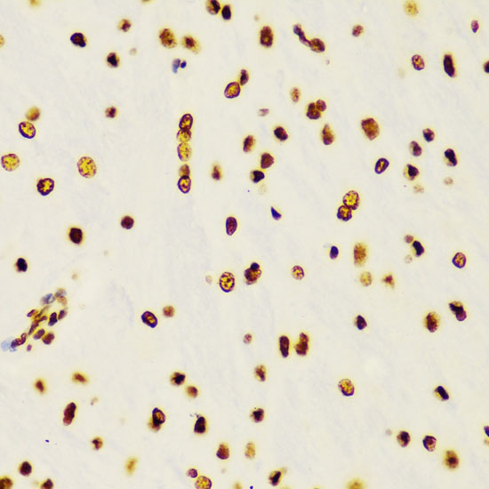 2 - DiMethyl-Histone H3 (Lys4) Rabbit mAb AP77005