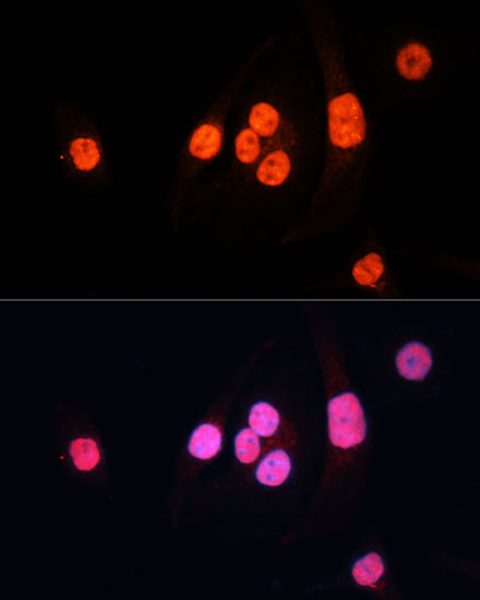 3 - METTL3 Rabbit mAb AP77003