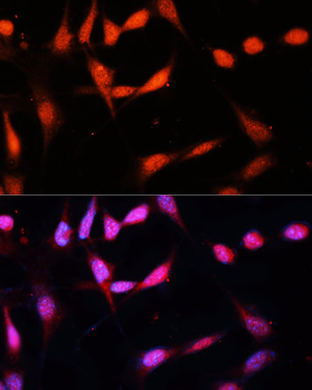 5 - METTL3 Rabbit mAb AP77003