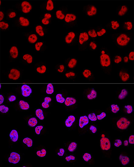 3 - METTL3 Rabbit mAb AP77003