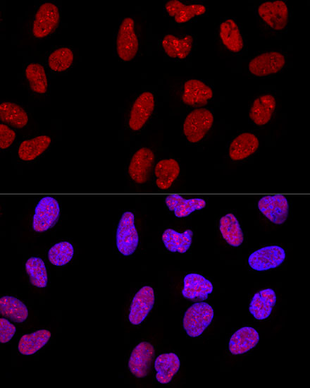 3 - METTL3 Rabbit mAb AP77003