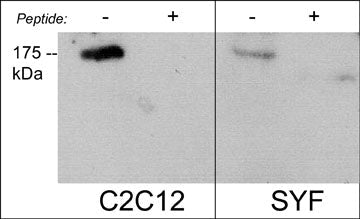 1 - Anti-Robo2 (C-terminal region) Antibody AN1940