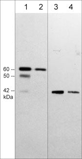 1 - Anti-Sphingosine Kinase 1 (C-terminal region) Antibody AN1968