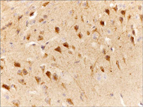 2 - Anti-Slingshot-1L (C-terminal region) Antibody AN1957