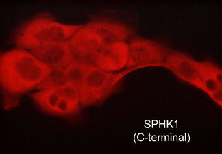 2 - Anti-Sphingosine Kinase 1 (C-terminal region) Antibody AN1968