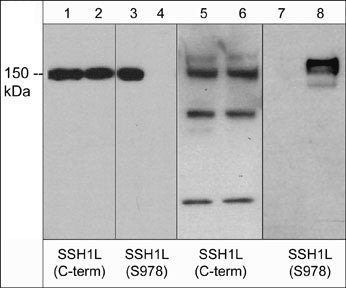 1 - Anti-Slingshot-1L (C-terminal region) Antibody AN1957