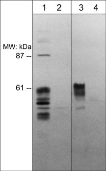1 - Anti-Semaphorin-3E (N-terminal region) Antibody AN1946