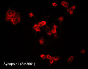 2 - Anti-Synapsin I (C-terminal region) Antibody AN1983