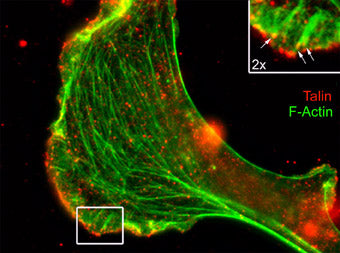 2 - Anti-Talin (Rod domain) Antibody AN1985